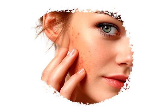 Skin Health